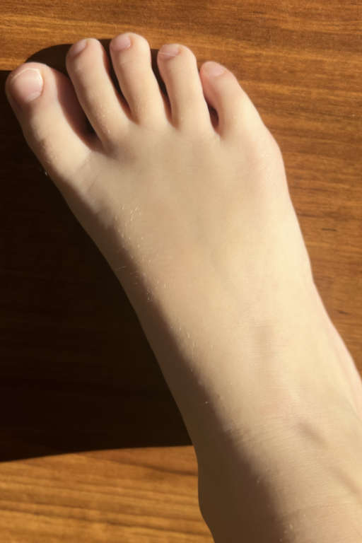 Christine foot 2 year follow-up