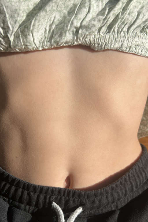 Christine front 2 year follow-up