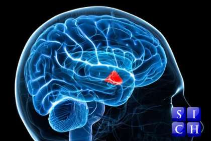 Hypothalamus SICH 420x280 stop hot flushes without HRT